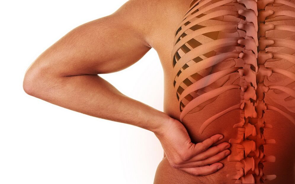 Réckschmerzen wéinst Osteochondrose