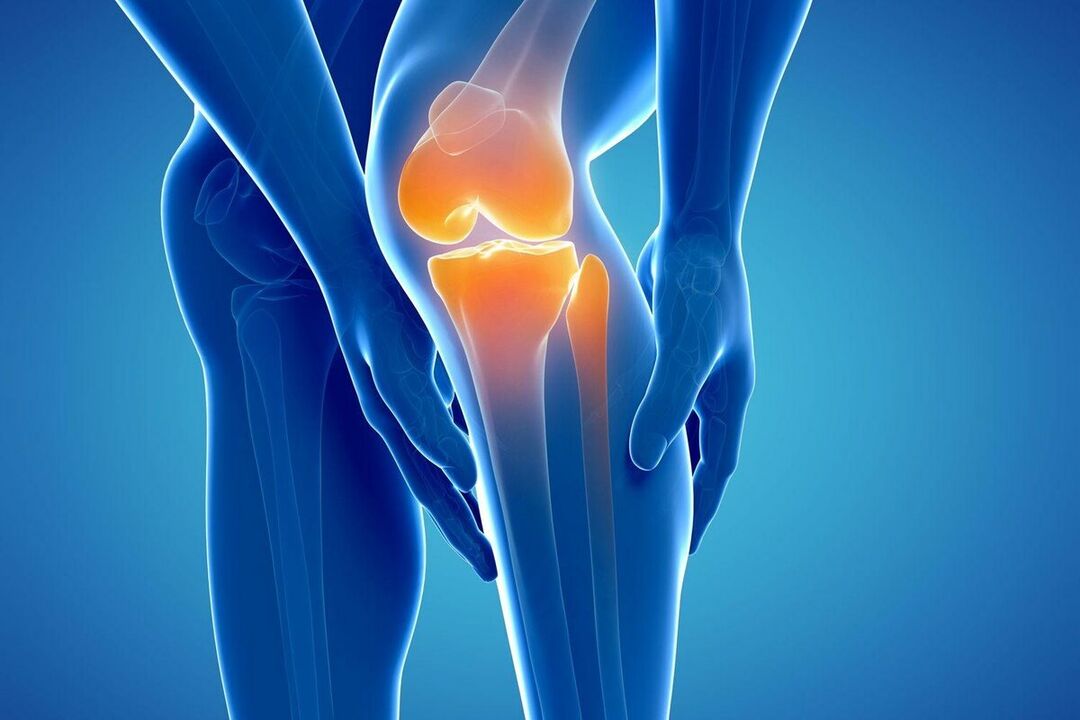 Wat ass Arthrosis