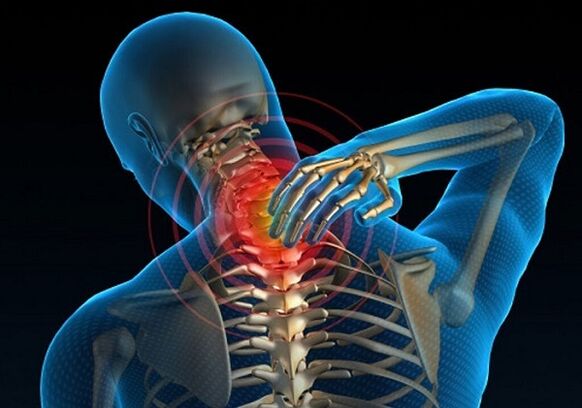 Hals Schmerz wéinst Osteochondrose
