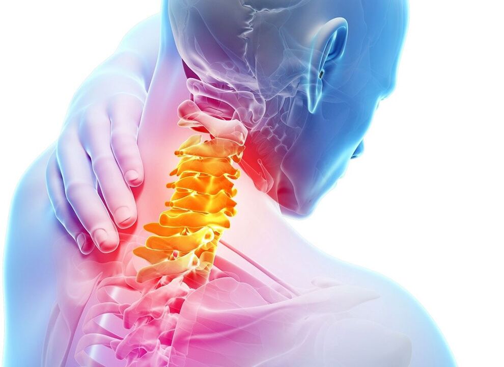 Lokaliséierung vun Osteochondrose